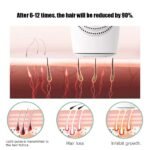 ⁦DEESS جهاز ليزر  ازالة الشعر دييس مع ميزة التبريد⁩ - الصورة ⁦4⁩