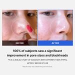 ⁦MEDICUBE- وسادات ميديكيوب زيرو بور⁩ - الصورة ⁦2⁩
