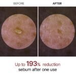 ⁦DR. MELAXIN- أمبولة دكتور ميلاكسين بيل شوت المقشرة بالأرز الأسود ٨٠ مل⁩ - الصورة ⁦4⁩