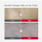 ⁦MEDICUBE- مقشر الجسم الأحمر لعلاج حب الشباب من ميديكوب - 110 مل⁩ - الصورة ⁦4⁩
