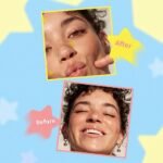 ⁦MLSMILE- ملسمايل – لصقات حبوب الوجه بشكل نجمة مبتسمة، 5 ألوان⁩ - الصورة ⁦7⁩