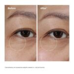 ⁦THE ORDINARY- ذا أورديناري كريم العينين لاكتو-PDRN* بتركيز 4% + فيتامين B9، 15 مل⁩ - الصورة ⁦3⁩