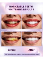 ⁦SMILEKIT – شرائط تبييض الأسن⁩ - الصورة ⁦2⁩